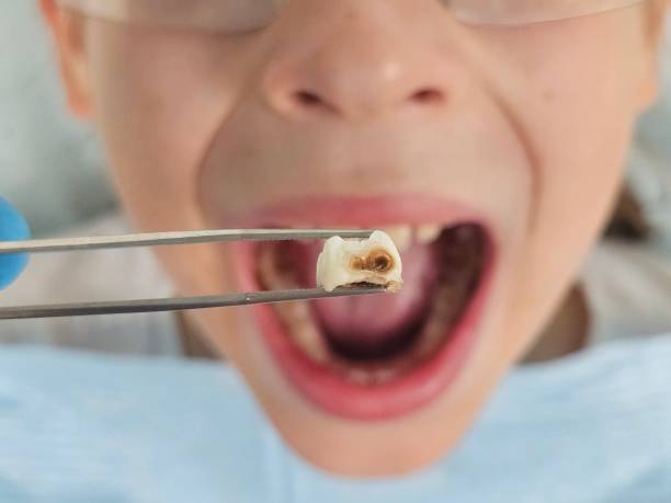 Best Emergency Dental Services for Seniors in Columbia, SC